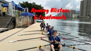 Rowing blisters 6 ways to treat them